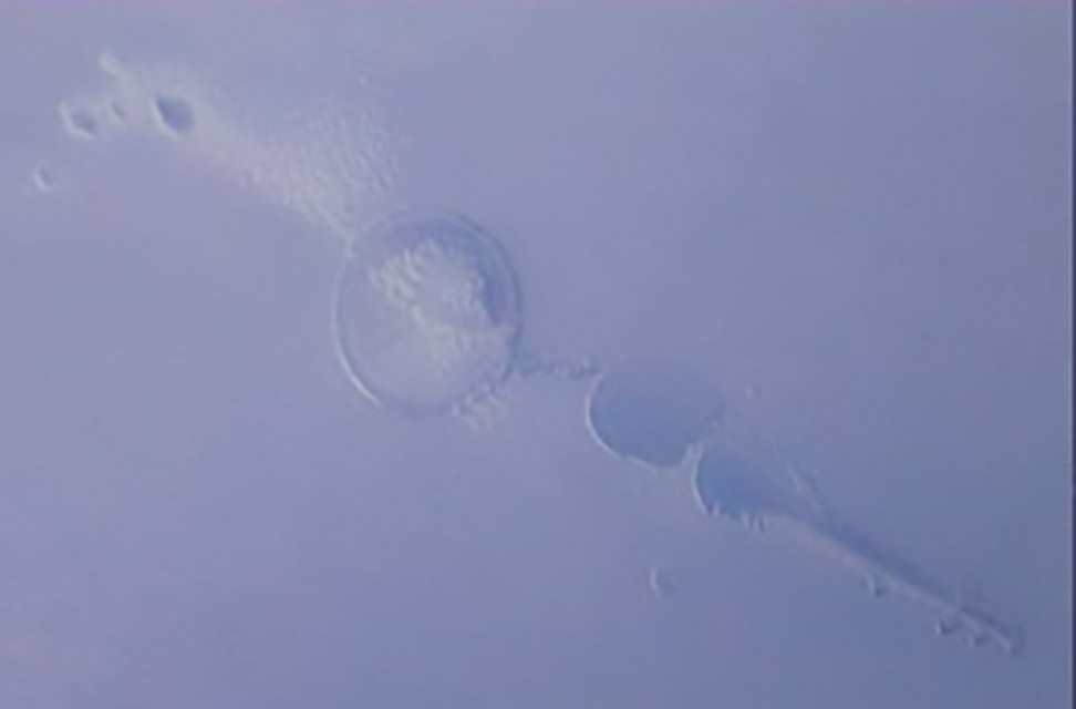 360-1-困气：注塑时带入空气